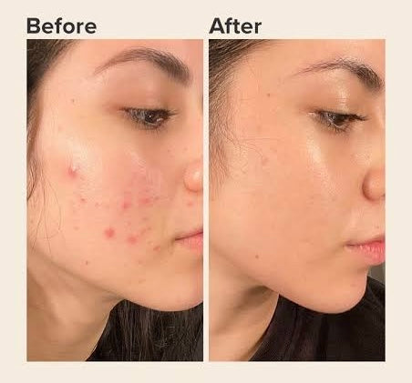 Skincare de Qualidade: Tenha uma Pele Radiante e Saudável